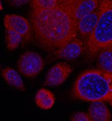 p70 S6 Kinase Rabbit Polyclonal Antibody