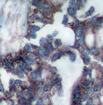 p70 S6 Kinase Rabbit Polyclonal Antibody