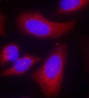 p70 S6 Kinase Rabbit Polyclonal Antibody