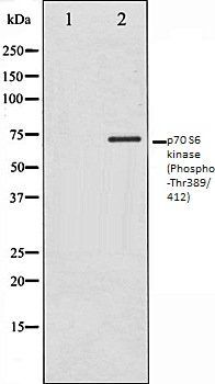 Phospho-p70 S6 Kinase (Thr389/Thr412) Antibody