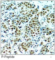 p90RSK (Phospho-Thr348) Antibody