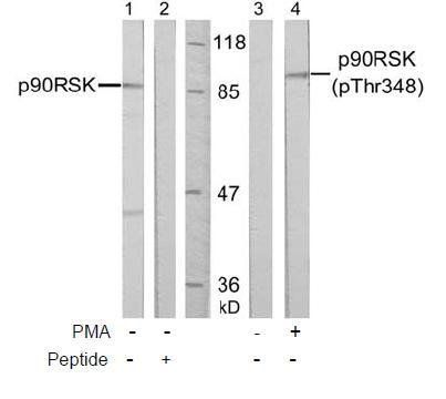 p90RSK (Phospho-Thr348) Antibody