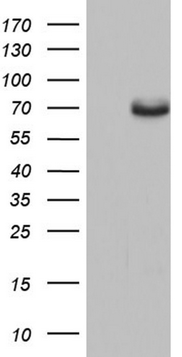 NBN Antibody