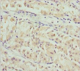 PACSIN2 Antibody
