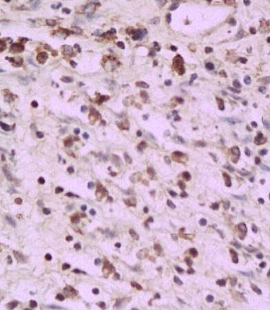 PAF Rabbit Polyclonal Antibody