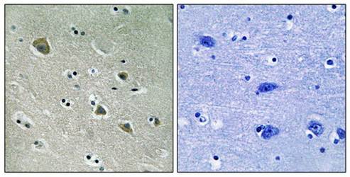 PAK1 (Phospho-Ser204) Antibody