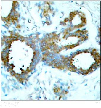 PAK1/PAK2/PAK3 (Phospho-Thr423/Thr402/Thr421) Antibody