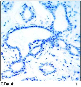 PAK1/PAK2/PAK3 (Phospho-Thr423/Thr402/Thr421) Antibody