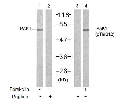 PAK1 (Phospho-Thr212) Antibody