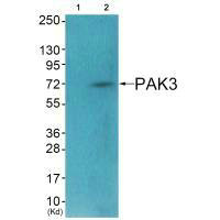 PAK3 Antibody