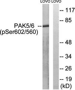 PAK5/6 (Phospho-Ser602/Ser560) Antibody