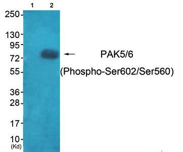 PAK5/6 (Phospho-Ser602/Ser560) Antibody