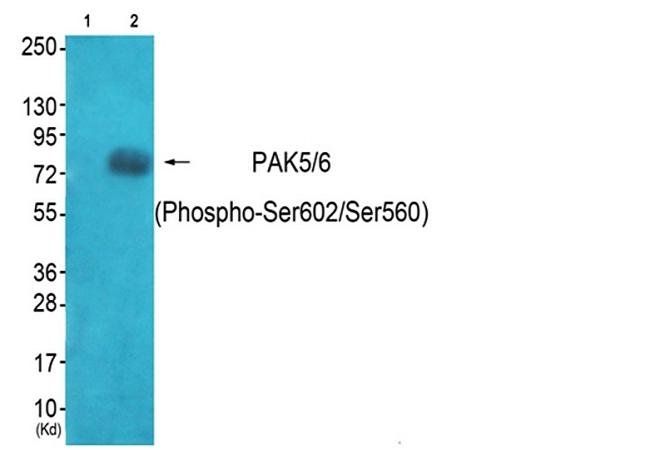 PAK5/6 (Phospho-Ser602/Ser560) Antibody