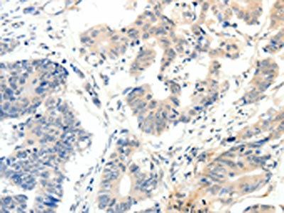 PAK5 Antibody