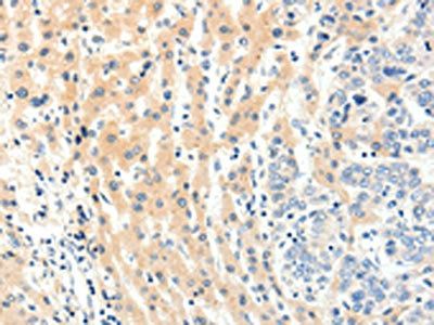 PAK5 Antibody