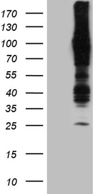 PALB2 Antibody