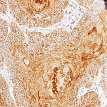 pan-Cytokeratin Rabbit Polyclonal Antibody