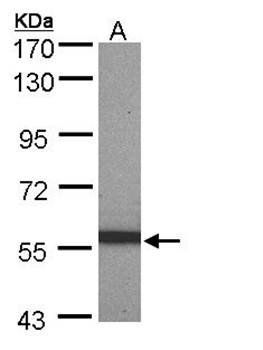 pan-Cytokeratin Rabbit Polyclonal Antibody