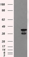 Pancreatic alpha amylase Antibody