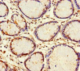 PTHLH Antibody