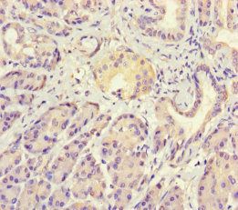 PTHLH Antibody
