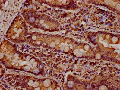 PARD3 Antibody