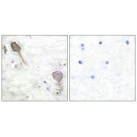 PRKN Antibody