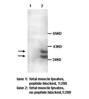 PARP11 Rabbit Polyclonal Antibody