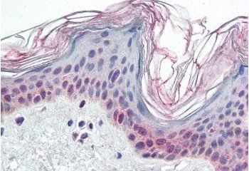Goat anti-PARP2 Antibody