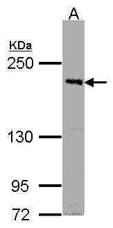 SEPHS2 Rabbit Polyclonal Antibody