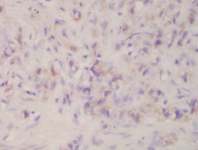 Patched Rabbit Polyclonal Antibody