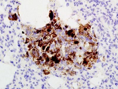 Patched Rabbit Polyclonal Antibody