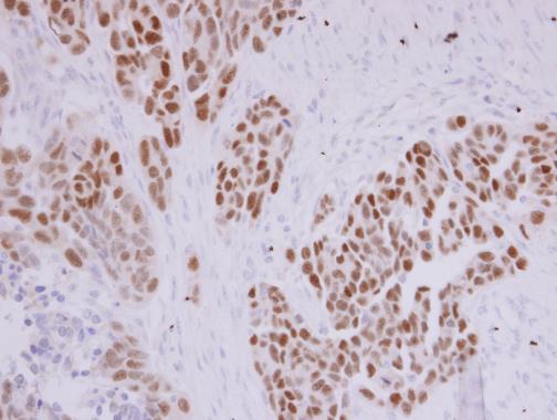 PAX8 antibody