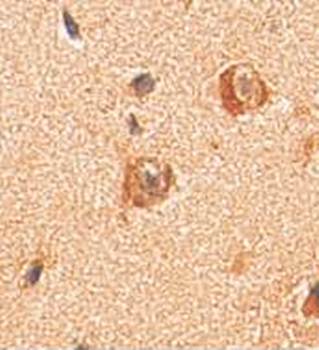 PAX9 Rabbit Polyclonal Antibody