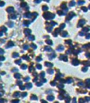 PCBP1 Rabbit Polyclonal Antibody