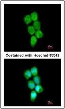 PCBP2 Rabbit Polyclonal Antibody