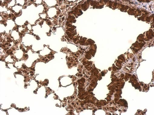 PCBP2 Rabbit Polyclonal Antibody