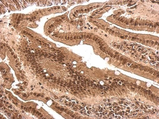 PCBP2 Rabbit Polyclonal Antibody