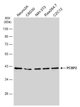 PCBP2 Rabbit Polyclonal Antibody