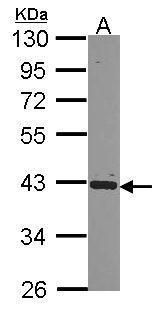 PCBP2 Rabbit Polyclonal Antibody