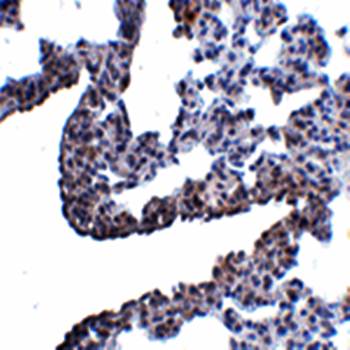PCDH12 Rabbit Polyclonal Antibody
