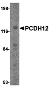 PCDH12 Rabbit Polyclonal Antibody