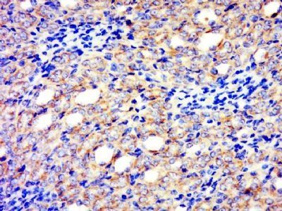 PCDHA7 Rabbit Polyclonal Antibody