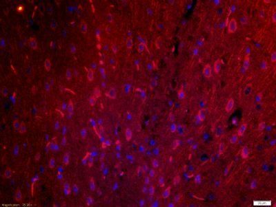 PCDHGA10 Rabbit Polyclonal Antibody