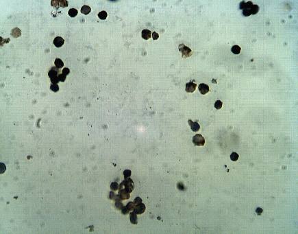 Rabbit Human Proprotein convertase subtilisin/kexin type 9 (PCSK9), LDLR-binding epitope blocking Antibody
