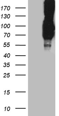 PCSK9 Antibody
