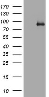 PD-L1 Antibody