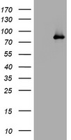 PD-L1 Antibody