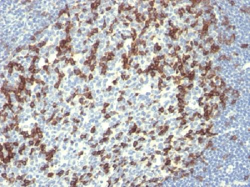 PDCD1 Antibody
