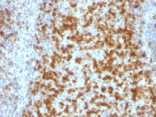 PDCD1 Antibody
